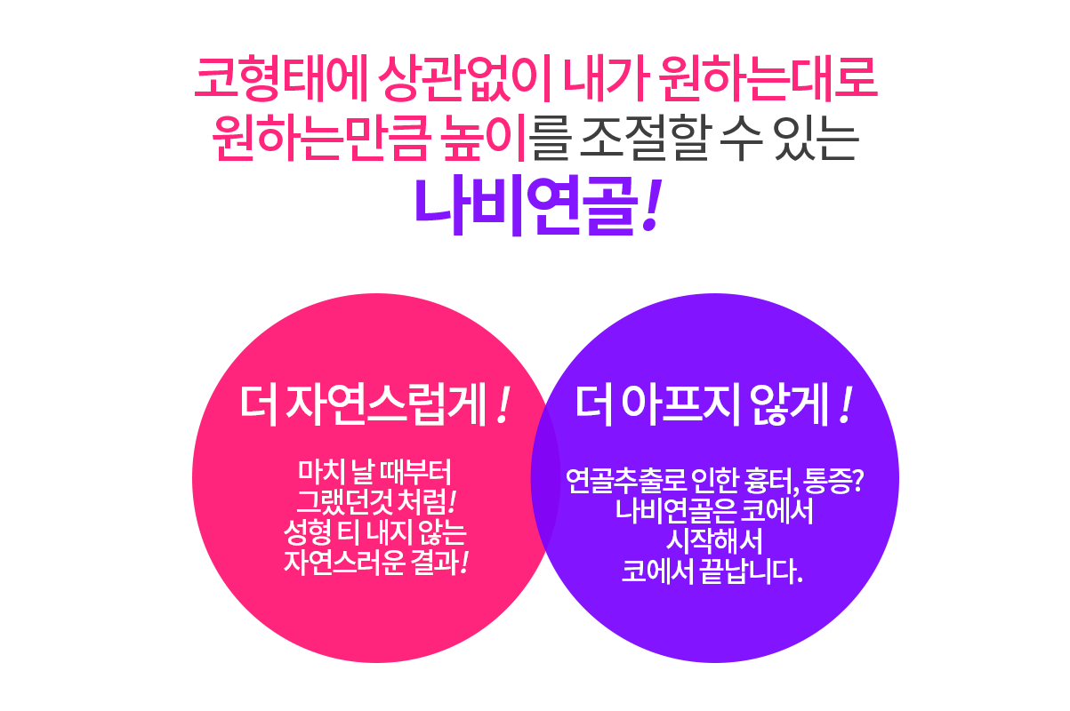 나비연골 코성형수술